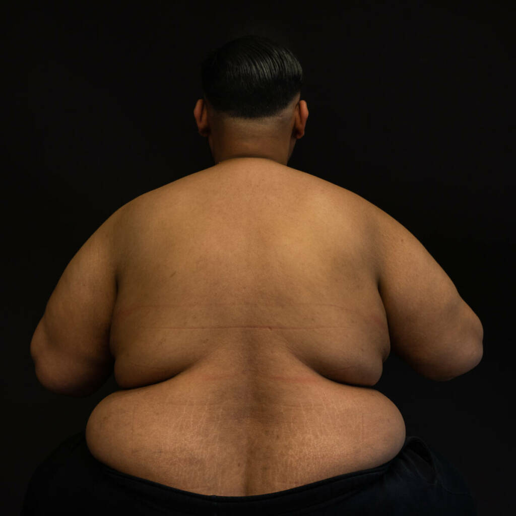 Photographie thérapeutique d